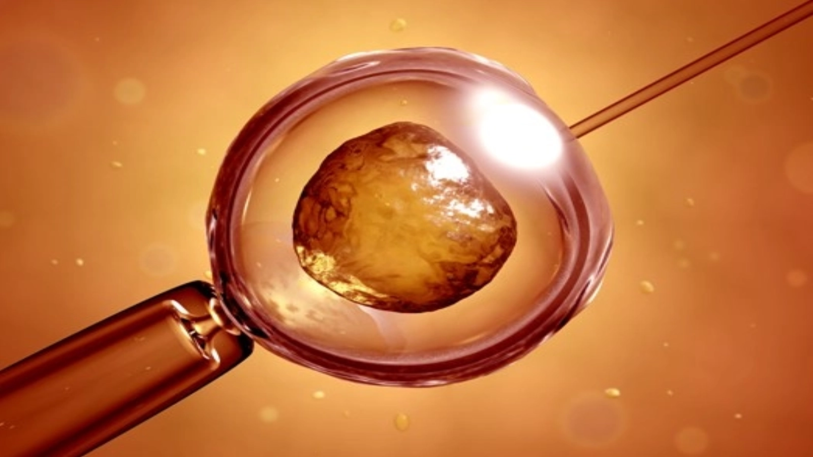 O nouă afacere 'crește' în jurul fertilizării in vitro: Procedura care promite să 'întinerească' ovulele, fără dovezi clinice solide, costă mii de euro