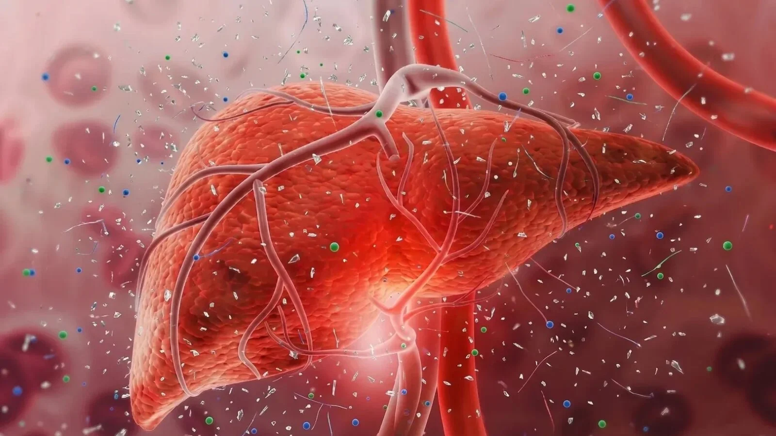 O echipă de medici a analizat 17 mostre de artere umane. Rezultatul este îngrijorător: Toate conțineau cantități mari de microplastice
