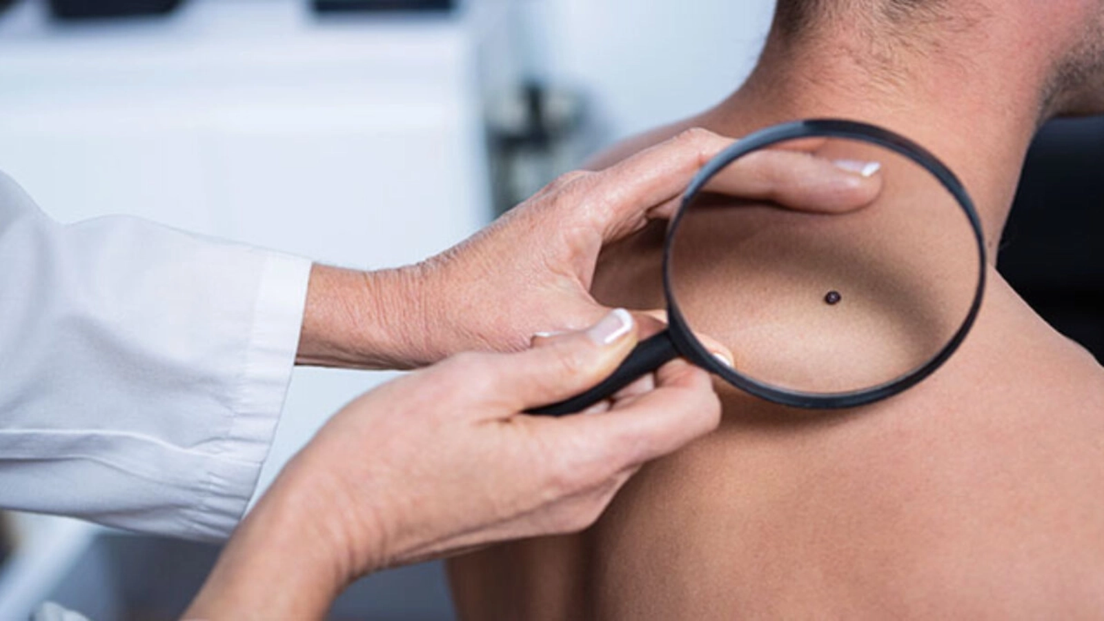 Un medic italian susține că razele solare nu cauzează cancer și că produsele de protecție solară sunt inutil: OMS a luat foc